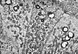 jejunum … unclassified vacuoles in enterocytes jejunum … unclassified vacuoles in enterocytes